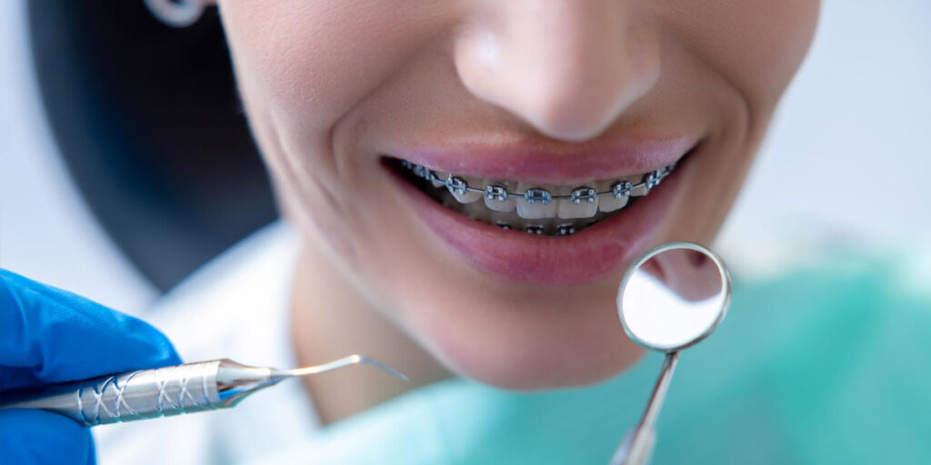 Comment se déroule un traitement orthodontique ?