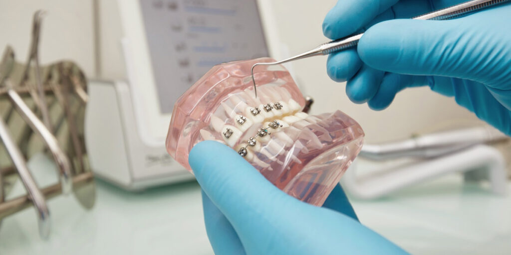 Orthodontie Le Mans, Orthodontie 72 : l’orthodontie, qu’est-ce que c’est ?